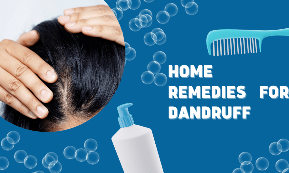 Home Remedies for Dandruff