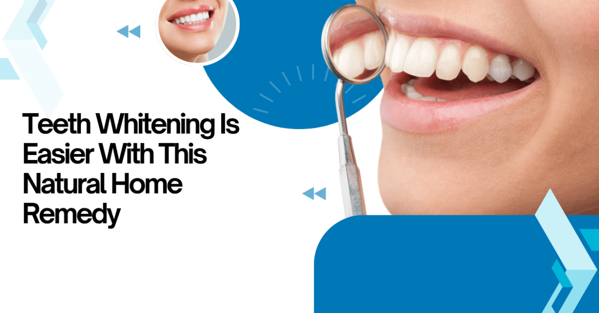 Teeth Whitening Is Easier With This Natural Home Remedy