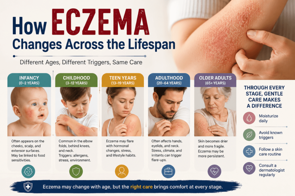 Is Eczema Contagious