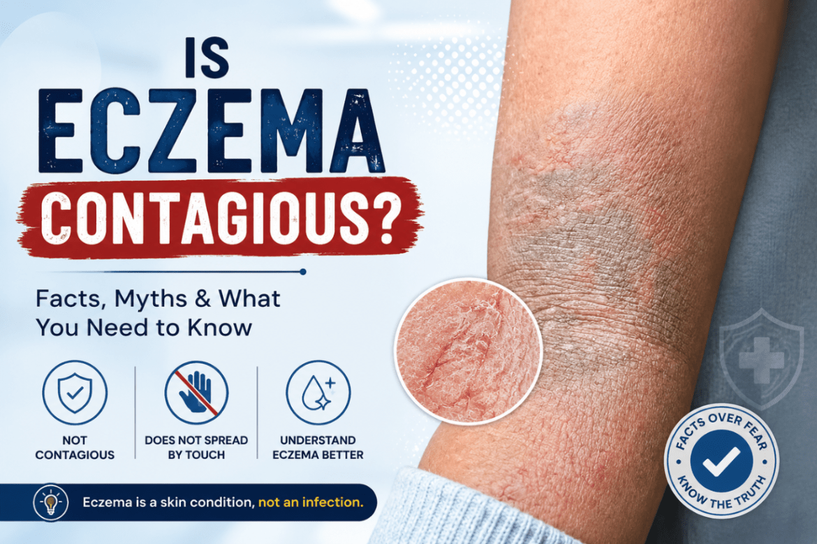 Is Eczema Contagious