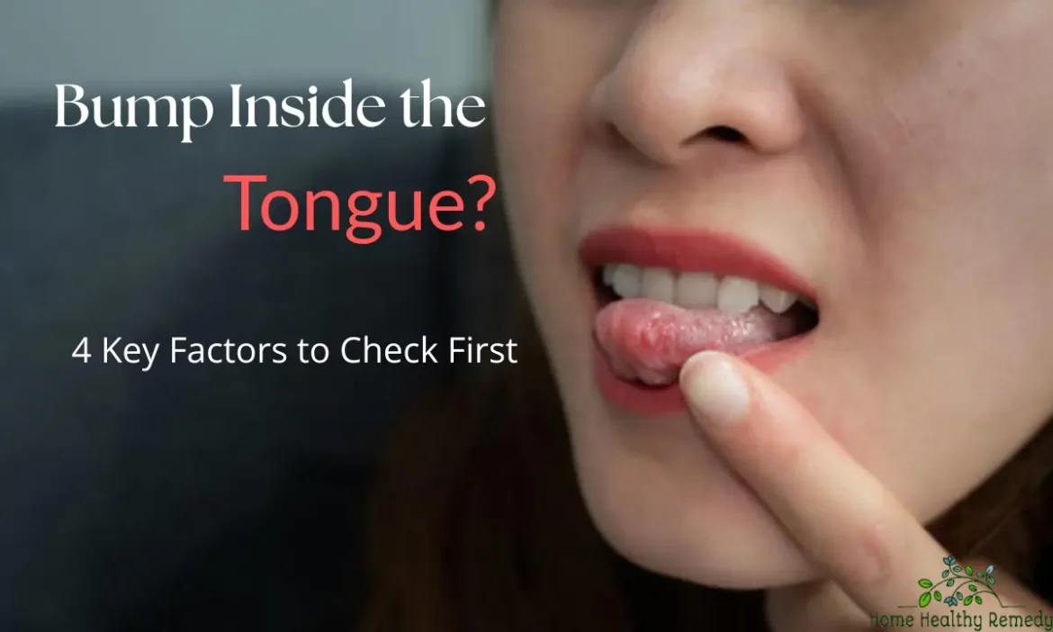 Close-up of a person pointing to a bump on the tongue, with text reading “Bump Inside the Tongue? 4 Key Factors to Check First.”