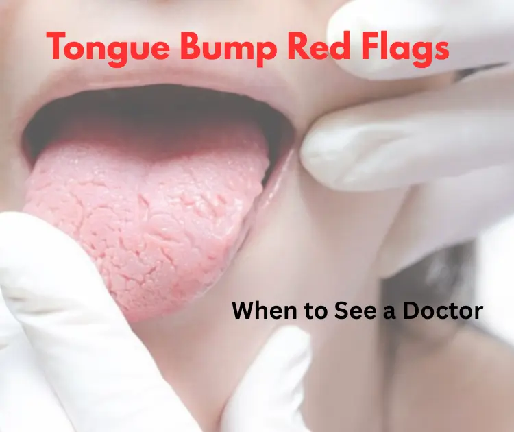 When to seek medical help when you have a bump inside the tongue
