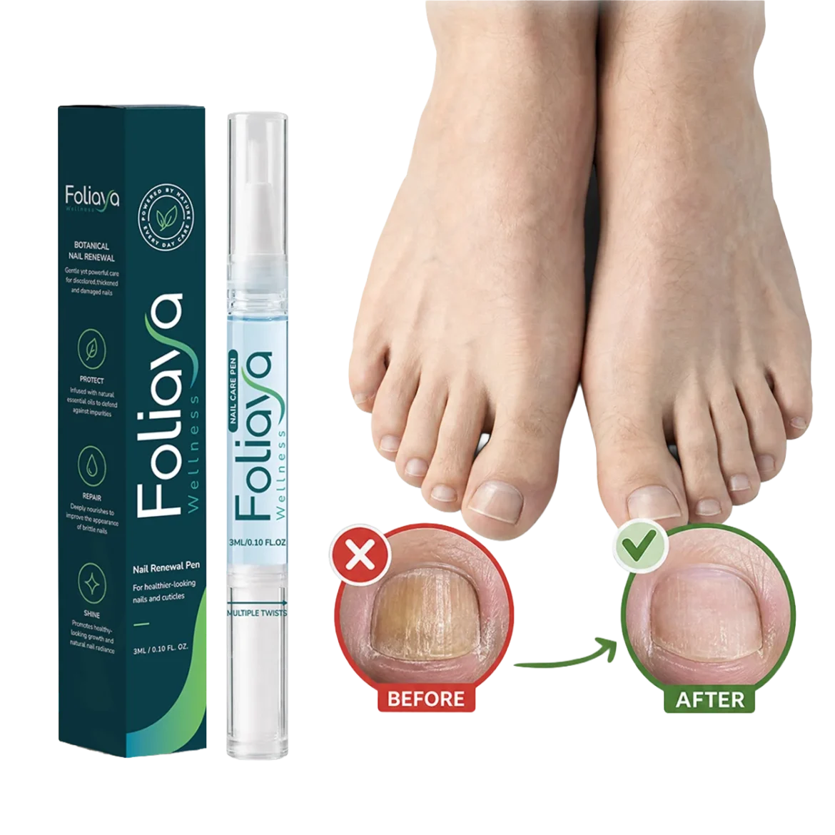 Foliaya Anti-Fungal Pen: A Complete Guide to Nail Fungus Treatment, Benefits, and Honest Pros & Cons